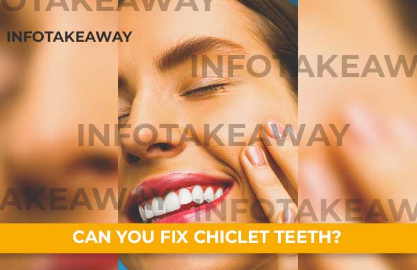 Can You Fix Chiclet Teeth