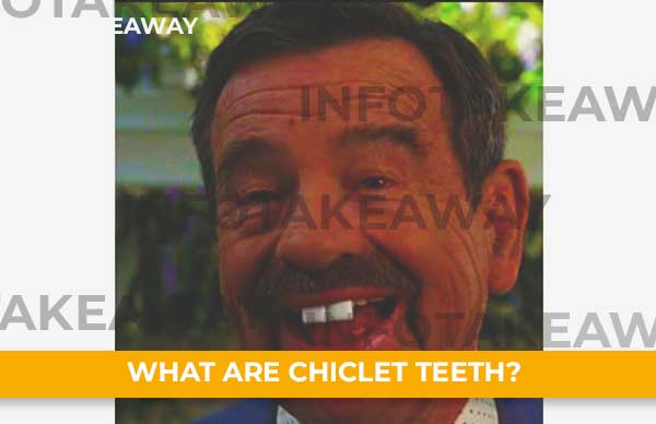 Chiclet Teeth