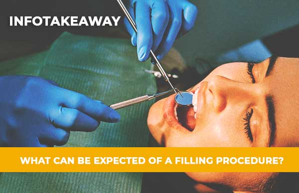 What Can Be Expected Of A Filling Procedure