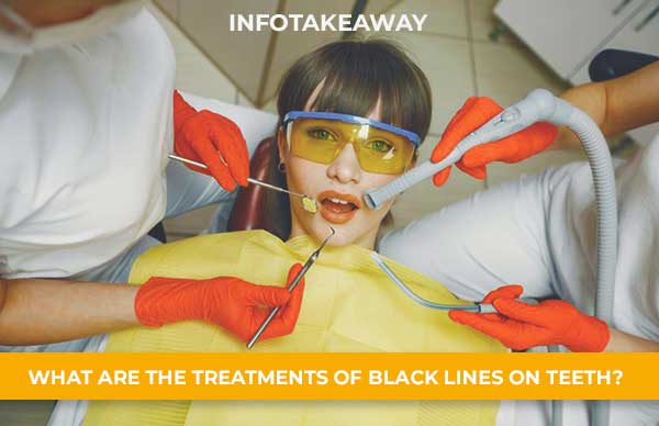 What Are The Treatments Of Black Lines On Teeth